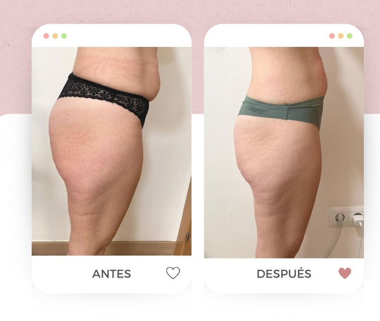 BODY GLOBAL.